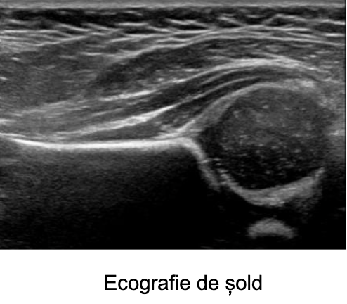 Ecografie de sold spitalulsfconstantin