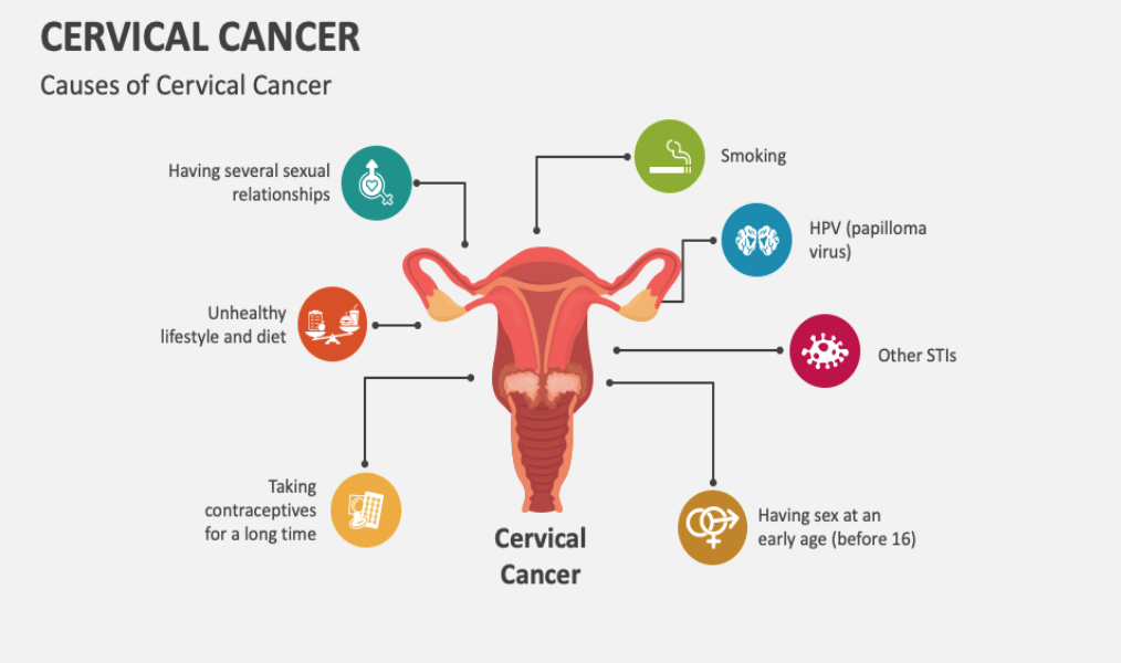 Cancerul de col uterin între prevenție și screening 3 Screenshot 2025 11 17 at 15.22.47