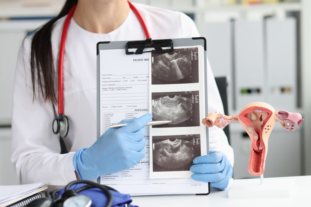 Cancerul de col uterin între prevenție și screening 1 cancer de col uterin