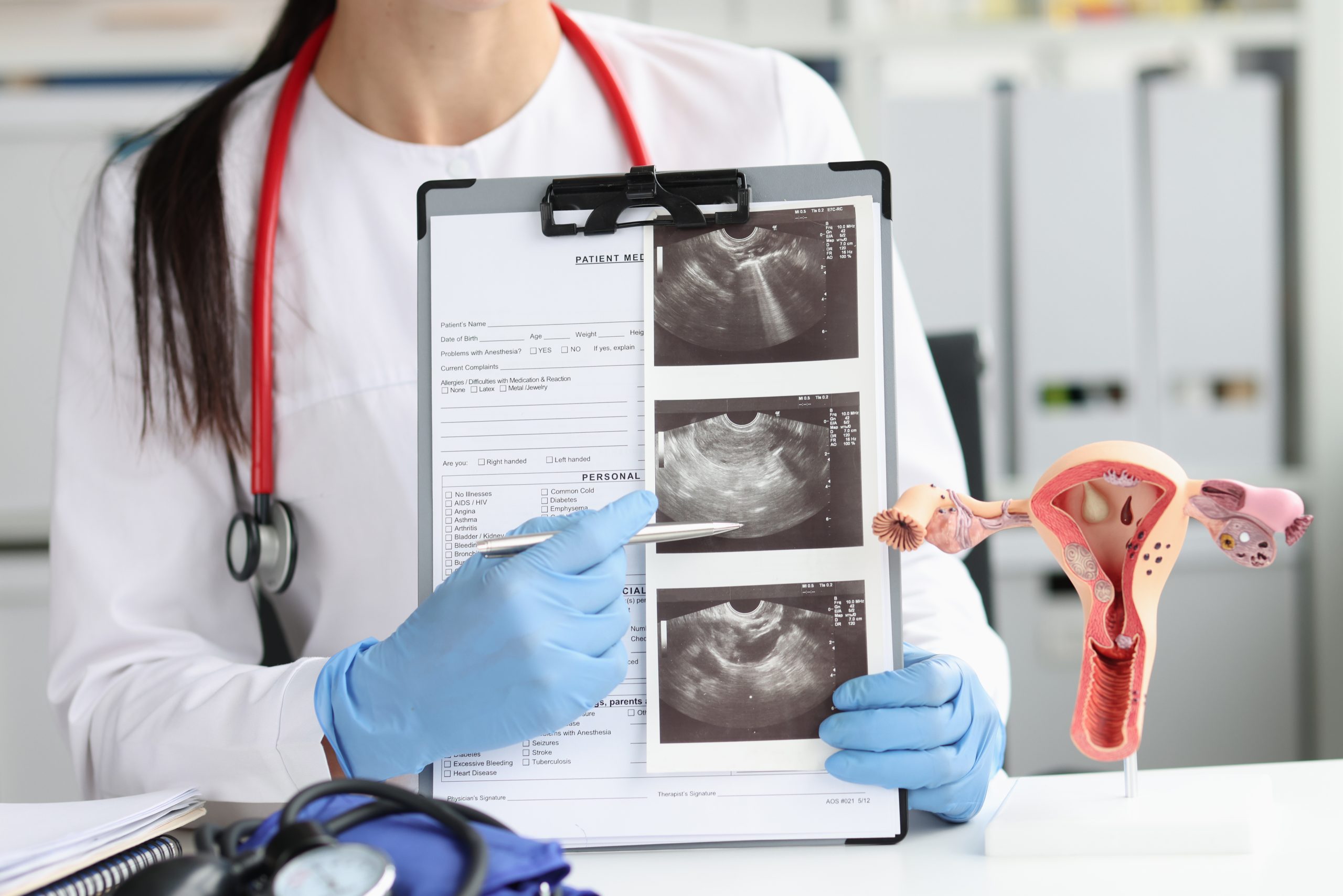 cancer de col uterin scaled