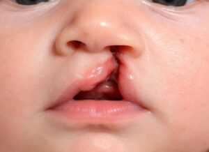 69eb4a74 6171 4dc6 a0fa 7c0cbb127b69ssss