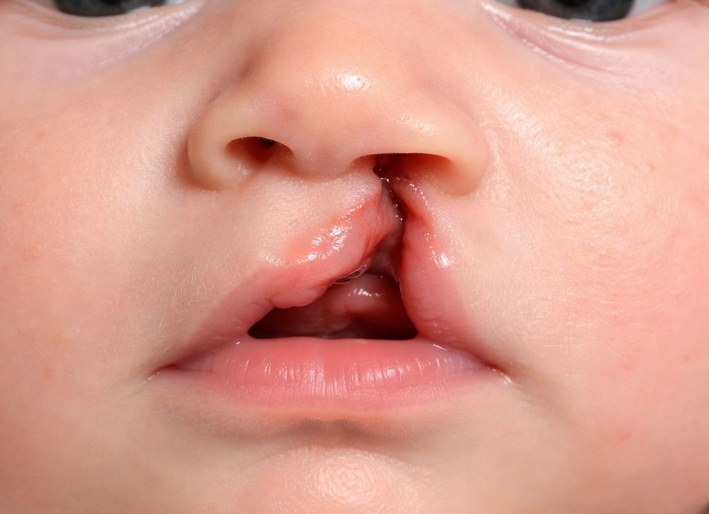 69eb4a74 6171 4dc6 a0fa 7c0cbb127b69ssss